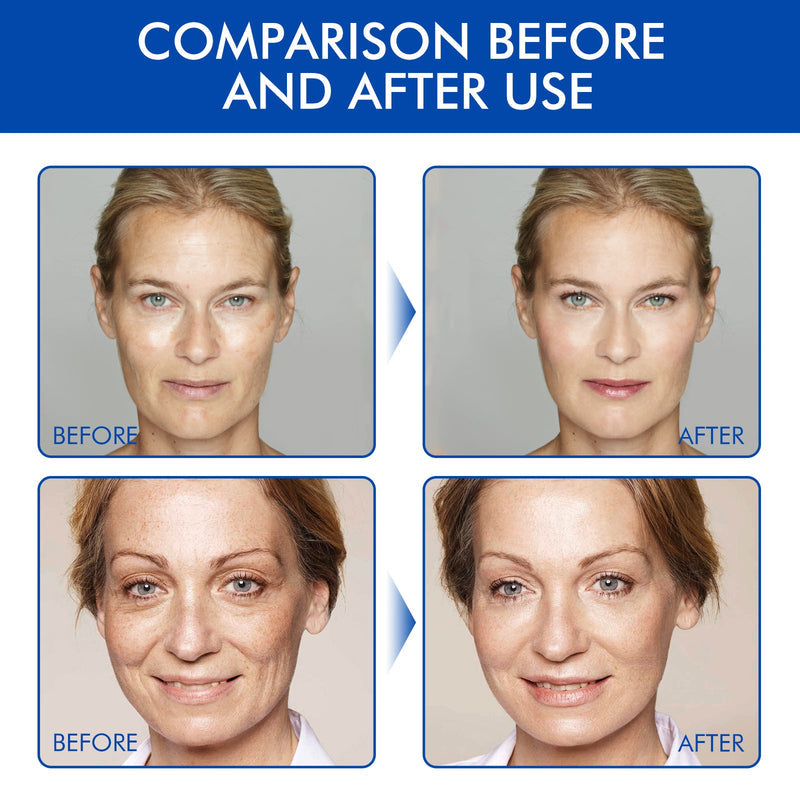 🔥 Limited-Time Sale - Anti-Aging Firming Peptide Lifting Serum - Free Sample (5g) Limited-Time