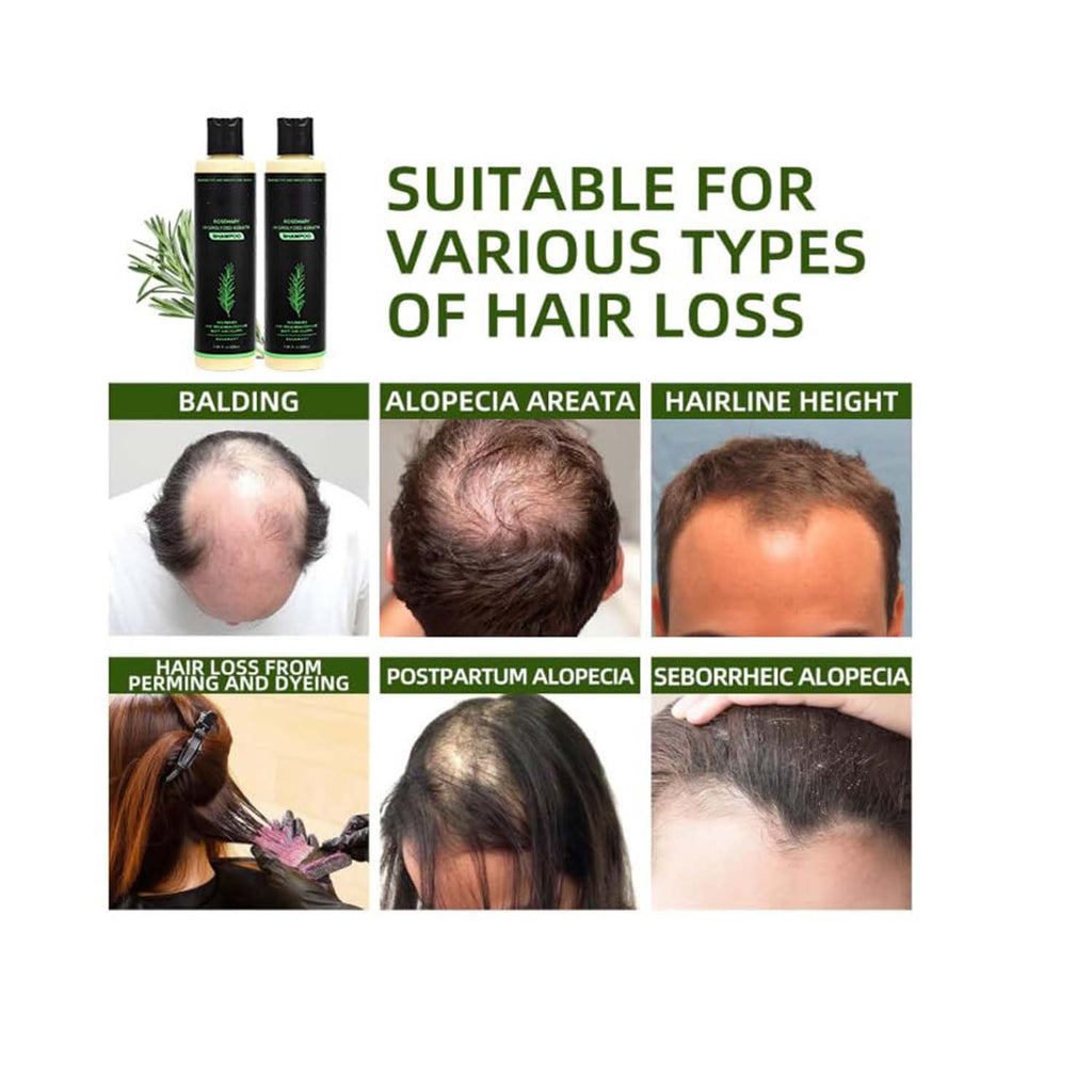 Organic Rosemary Hair Growth Shampoo with Hydrolyzed Keratin for Thinning Hair & Breakage 7.4 oz