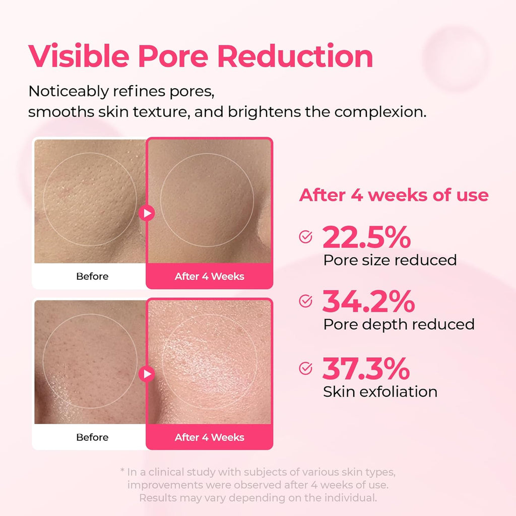 Final 3 Hours: 60%OFF🔥 Gifted Collagen Boost 5-Step Set Calcium Collagen Balm for Firming & Pore Care