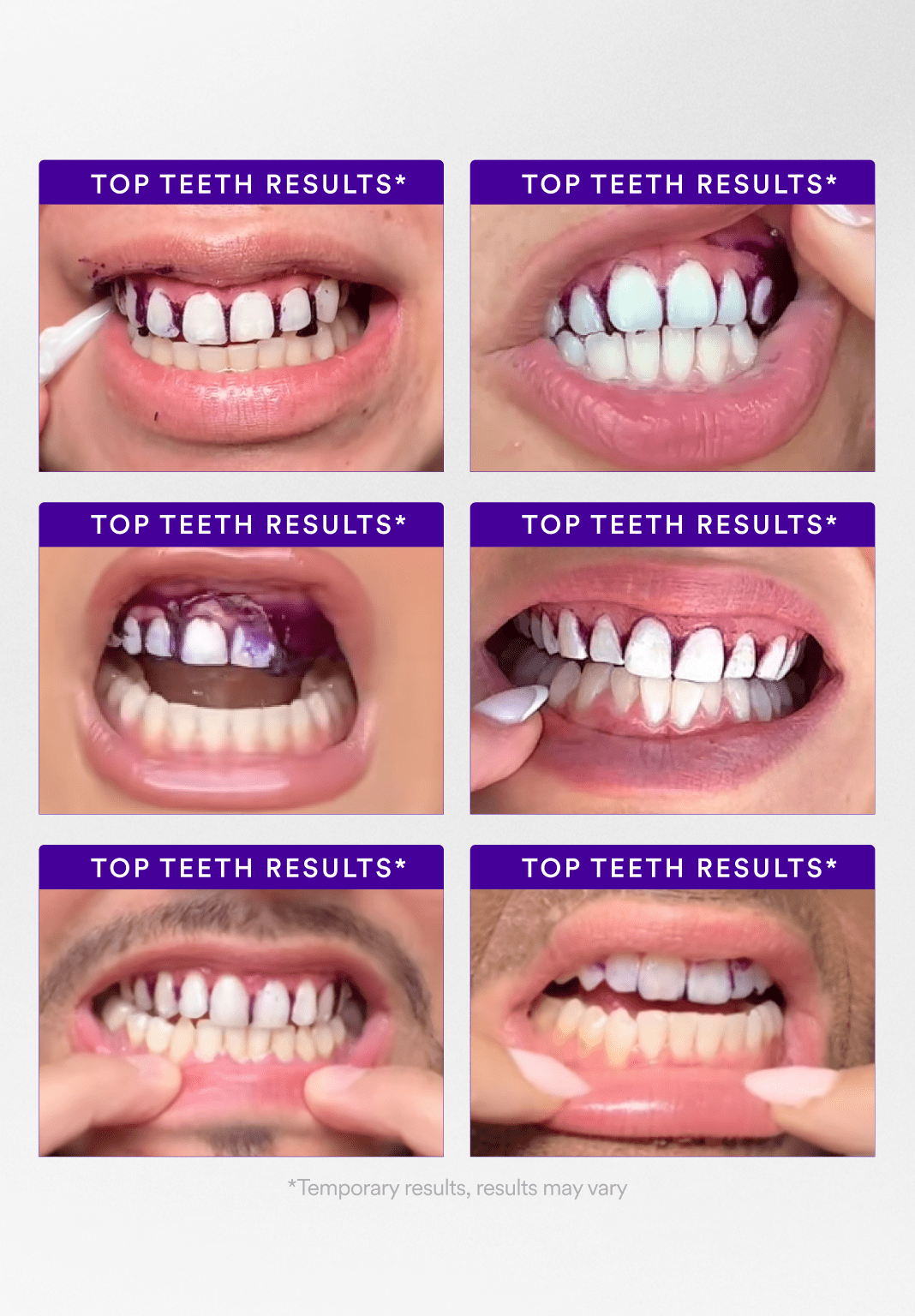 Hismile V34 Whitening Strips- 8x Brighter Smile, Enamel Safe, Non-Sensitive