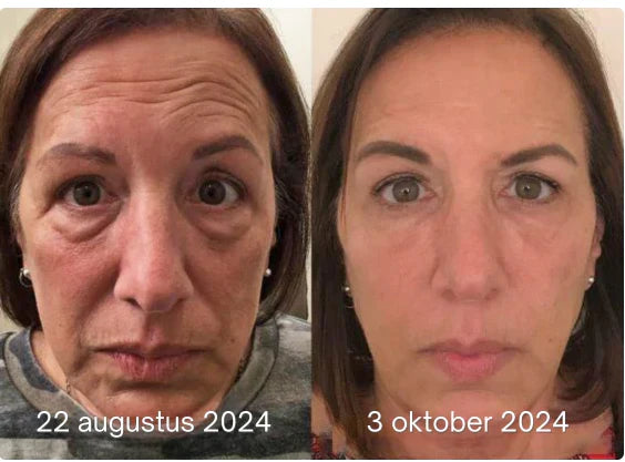 🔥 Limited-Time Sale - Anti-Aging Firming Peptide Lifting Serum - Free Sample (5g) Limited-Time