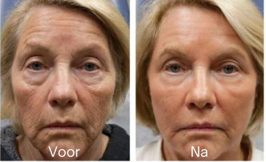 🔥 Limited-Time Sale - Anti-Aging Firming Peptide Lifting Serum - Free Sample (5g) Limited-Time