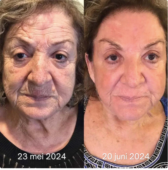 🔥 Limited-Time Sale - Anti-Aging Firming Peptide Lifting Serum - Free Sample (5g) Limited-Time