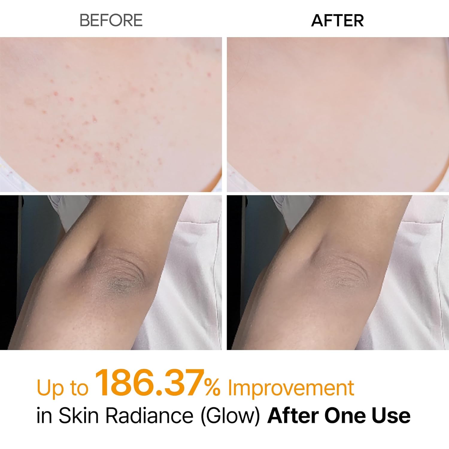 Kojic Acid & Turmeric Exfoliating Body Spray with Keratin for All Skin Types 200ml