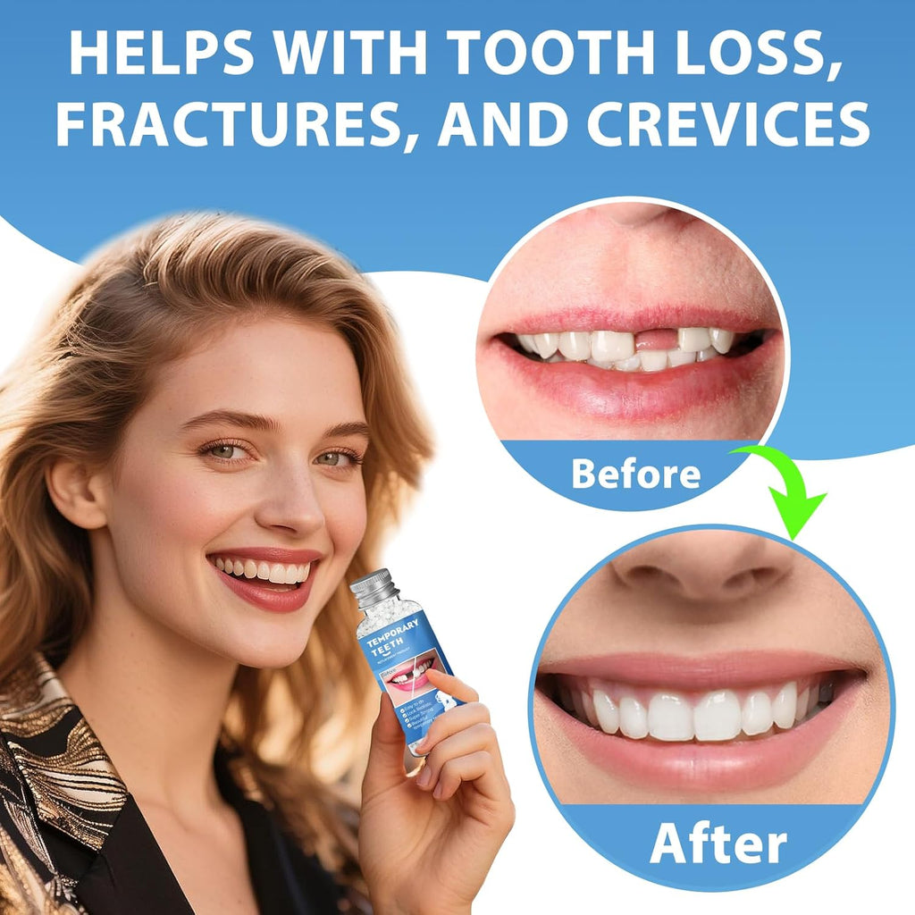 Moldable Teeth Repair Beads for Missing & Cracked Teeth - DIY Dental Restoration Kit