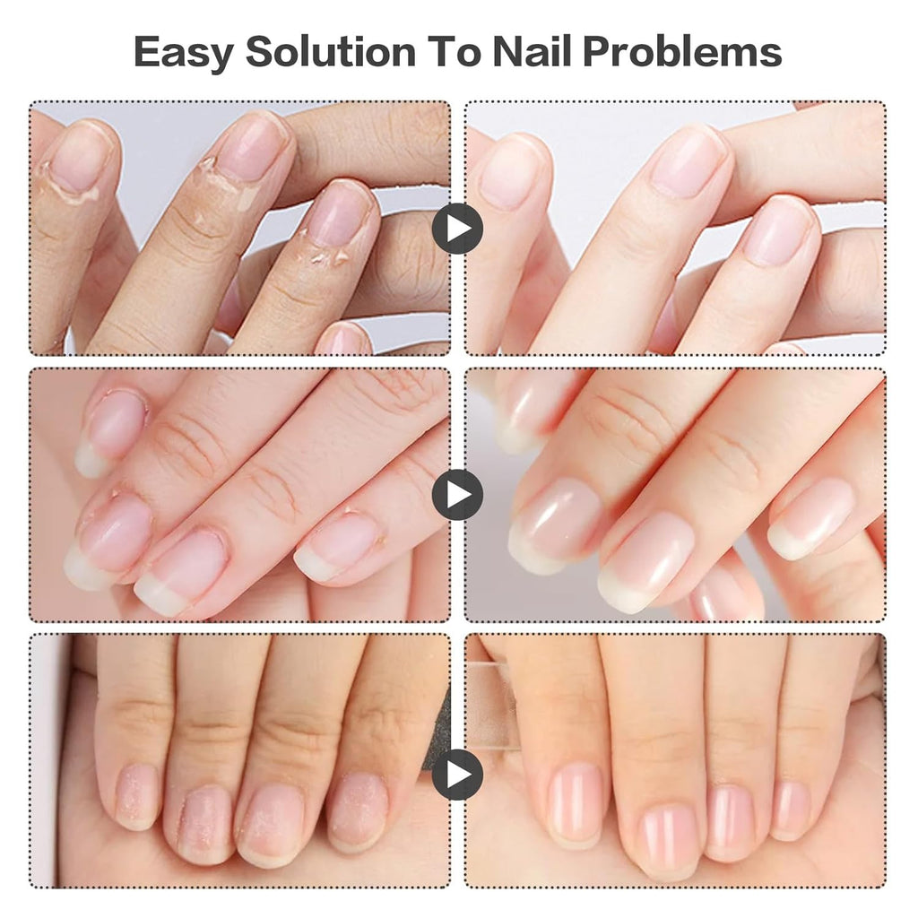 Nail Growth & Repair Oil Pen - 3 Pack for Stronger, Healthier Nails