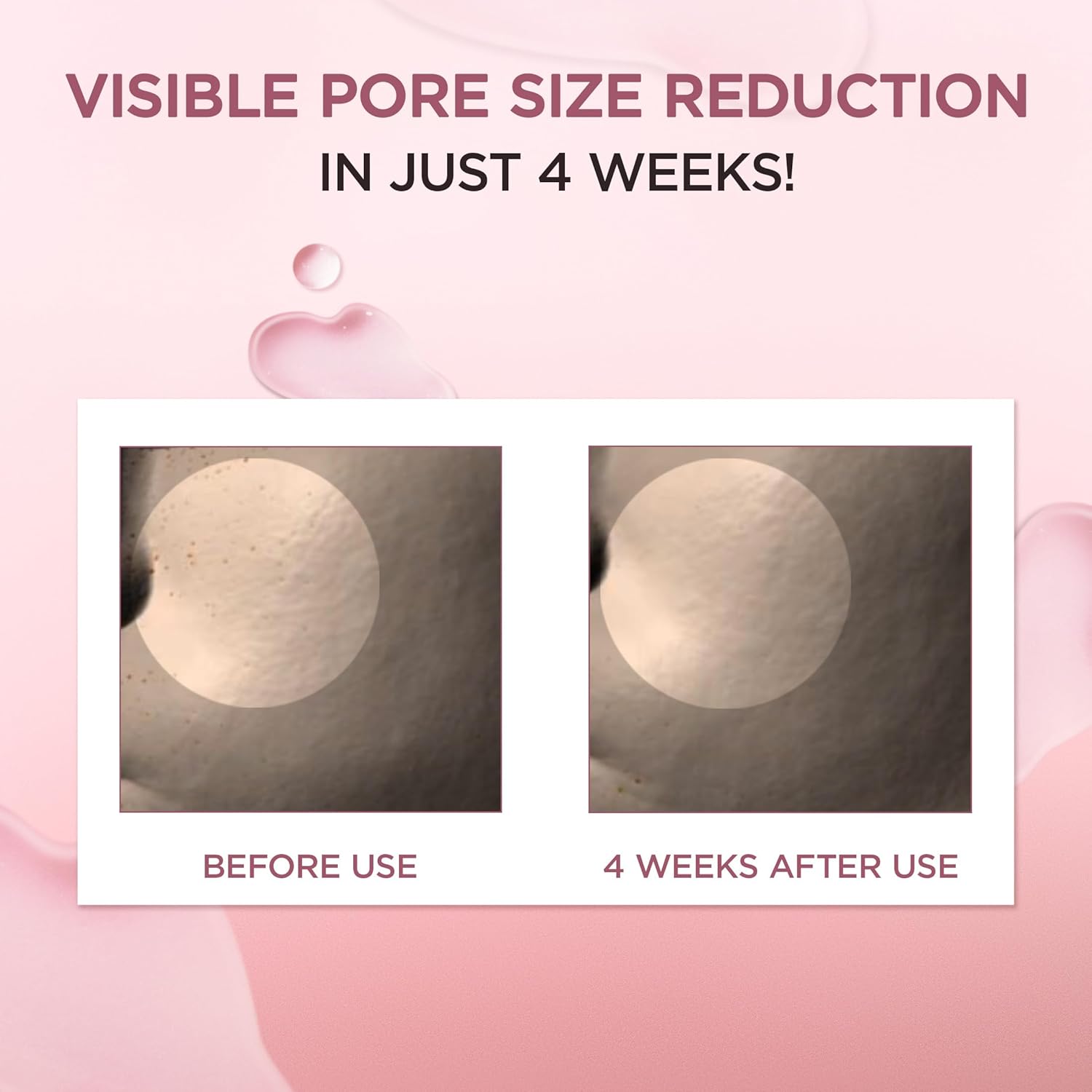 Madagascar Centella Poremizing Fresh Ampoule 3.38oz | Soothing Hydration for Oily & Combination Skin