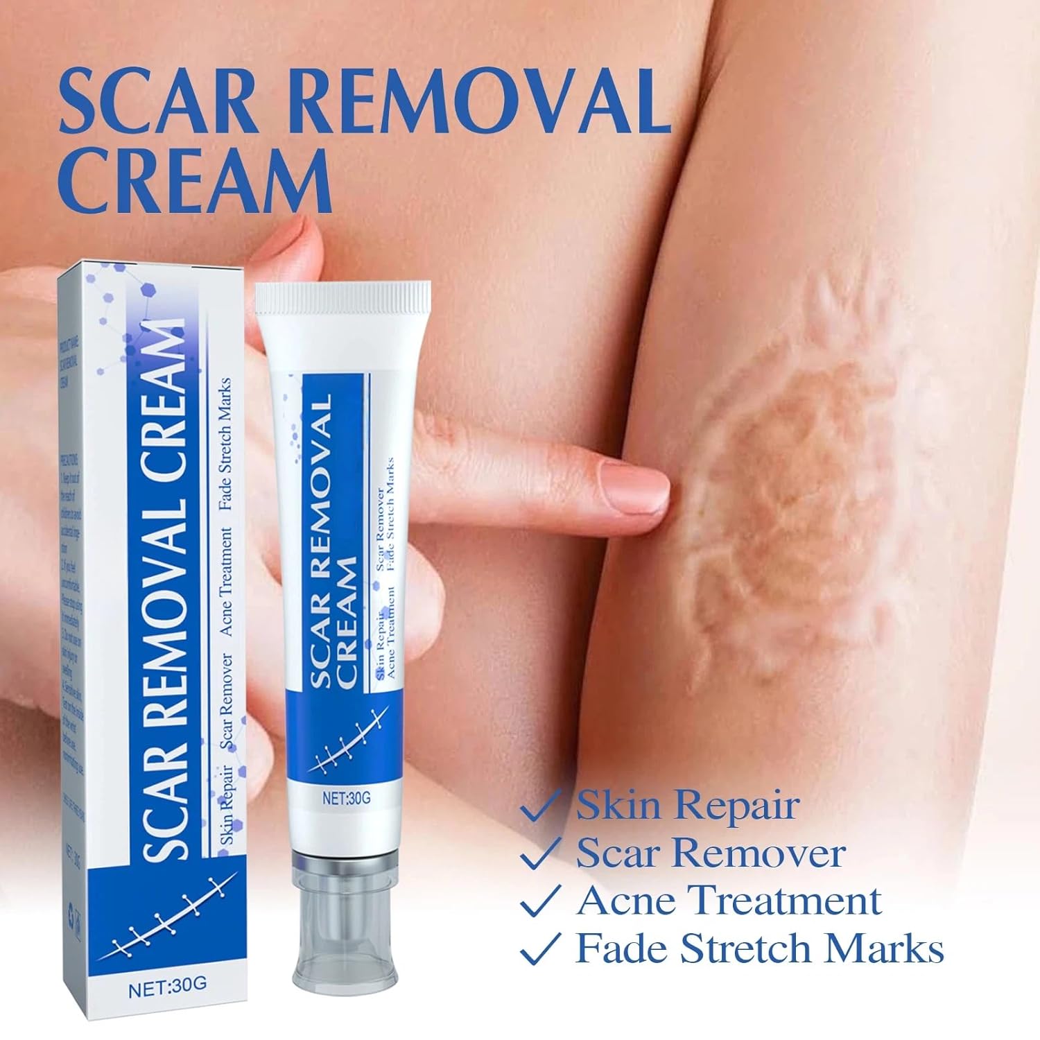 Gentle Scar Soothing Gel with Aloe Vera & Mineral Oil - 30g Hydrating Formula for Face & Body
