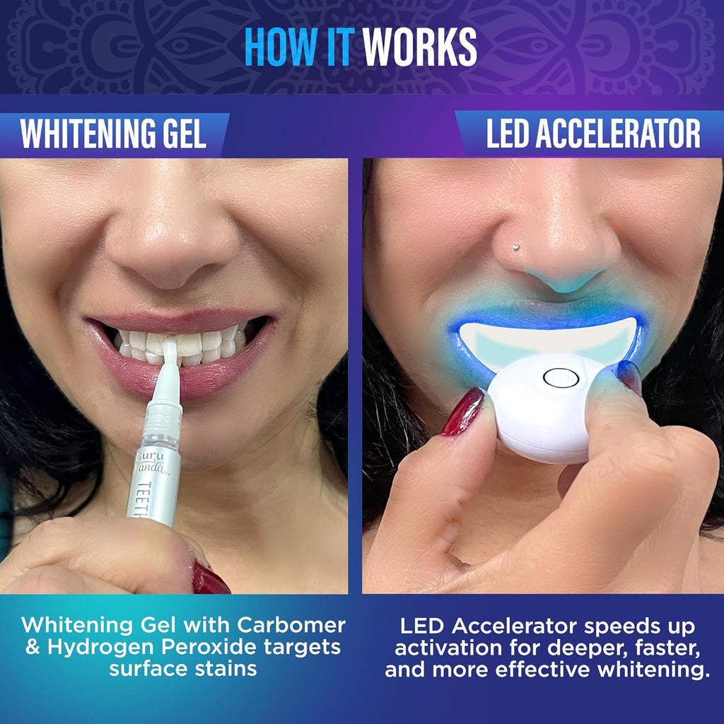 Professional Wireless Teeth Whitening Kit with LED Light & Whitening Pen, 40 Treatments