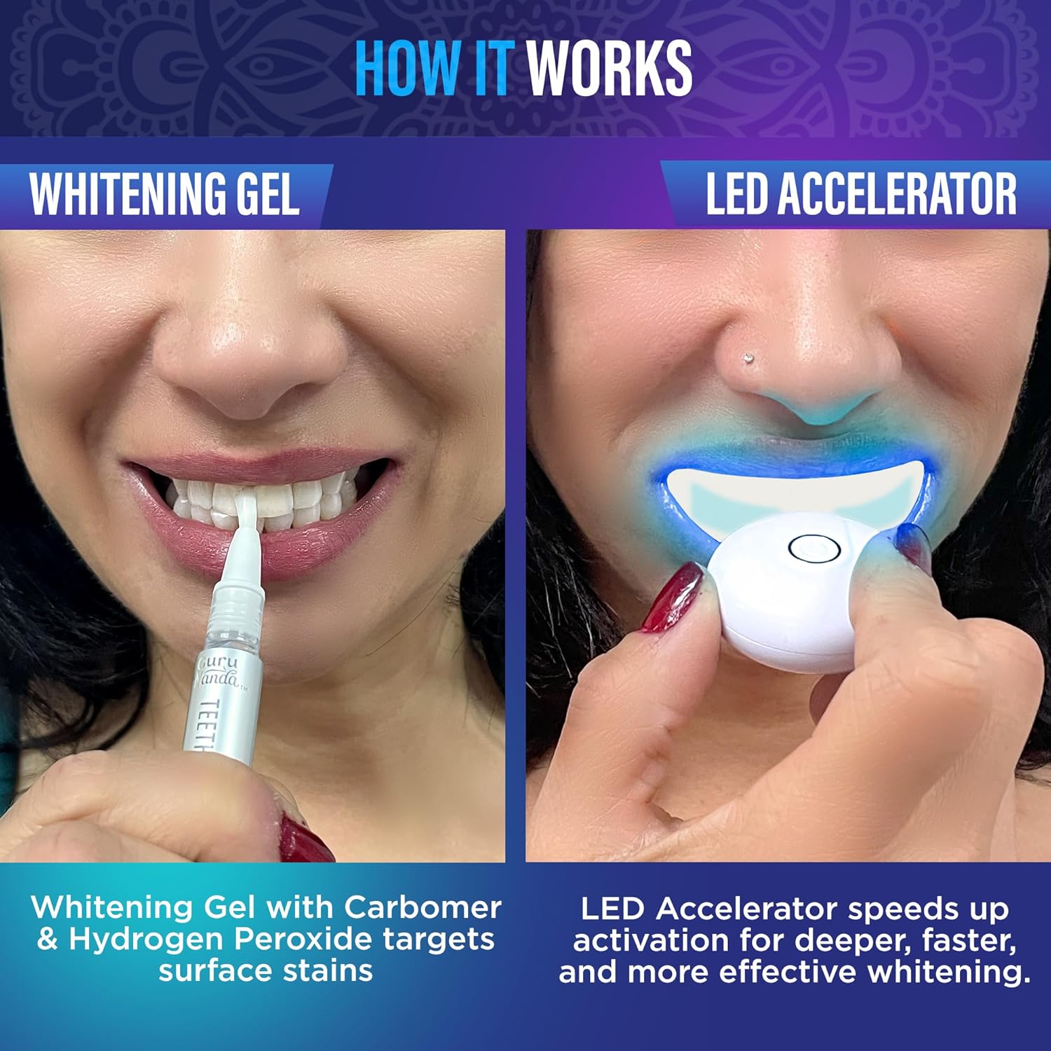 Professional Wireless Teeth Whitening Kit with LED Light & Whitening Pen, 40 Treatments