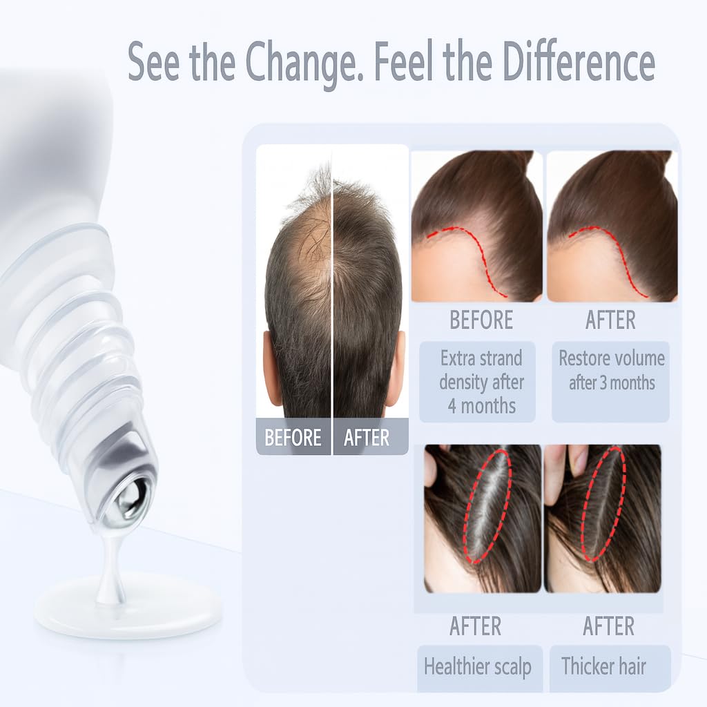 3% Rosemary Hair Growth Serum Roll-On | Thicker Hair & Beard | Prevents Hair Fall | 25ml