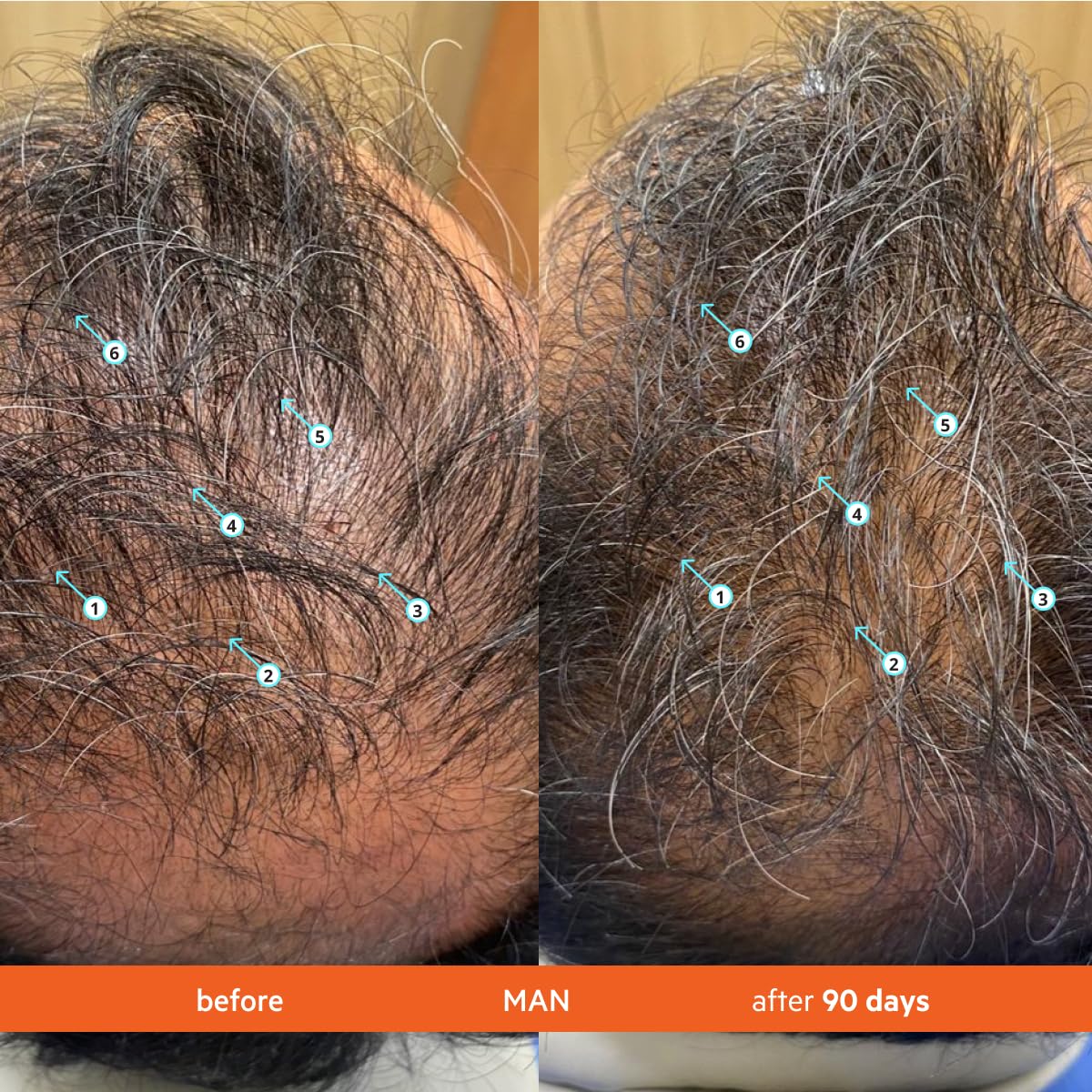 Volumizing Shampoo for Fuller Looking Hair, Scalp Refreshing Cleanse & Lightweight Hydration, 205 mL